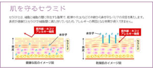 セラミド